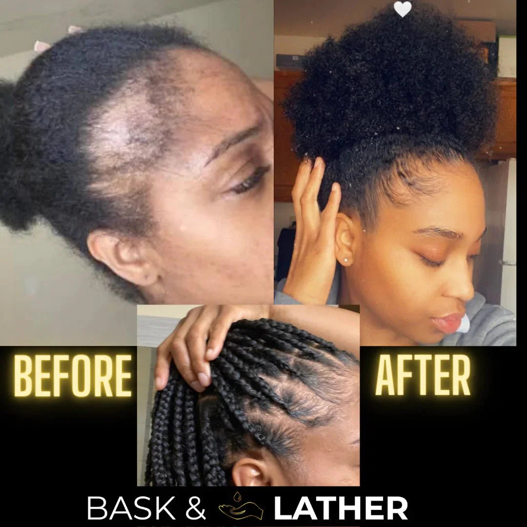 Complete Natural Haircare System for Growth & Hydration | Hair Elixir + Scalp Stimulator Oil + Balm + Hydrating Mist